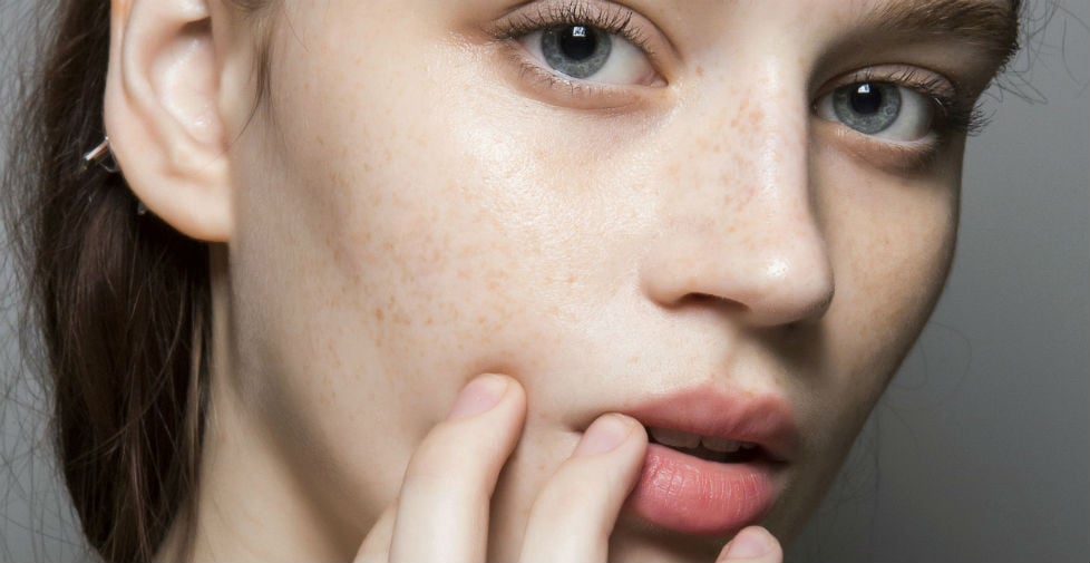 Your Preventative Botox Questions, Answered (by Nurse Jamie!)