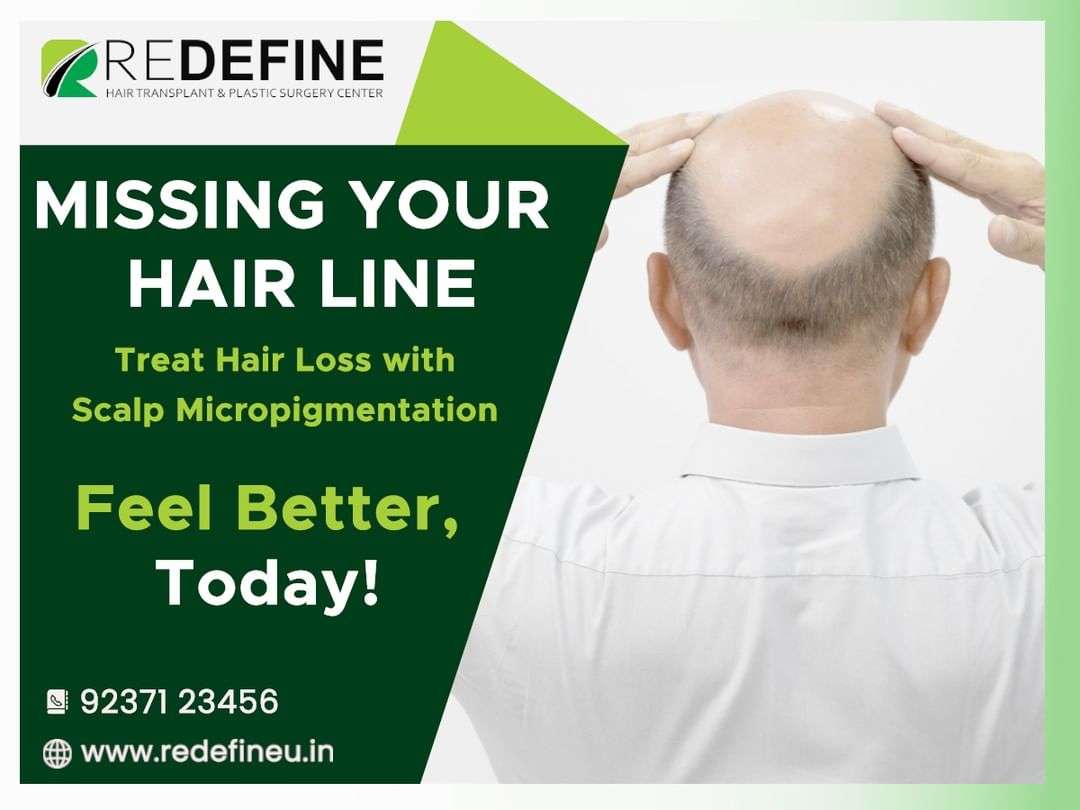 Image with missing alt attribute found on redefineu.in