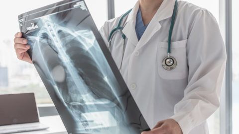 Image with missing alt attribute found on 24.hu