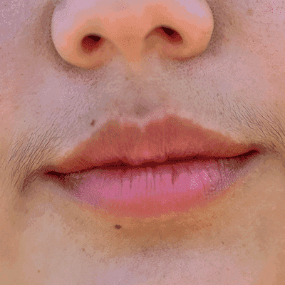 Image with missing alt attribute found on alivaaesthetics.com