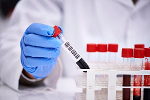 Image with missing alt attribute found on autogear.ru