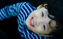 Gi&aacute; trị của can thiệp chỉnh nha sớm