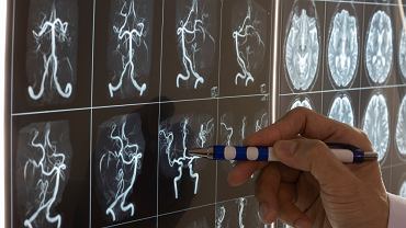 Image with missing alt attribute found on tokfm.pl