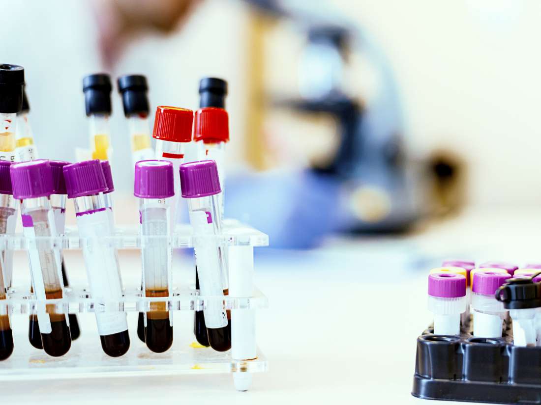 Excessive blood fat could cause organ damage