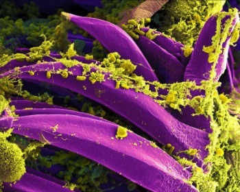 C&eacute;lula eucariota y c&eacute;lula procariota