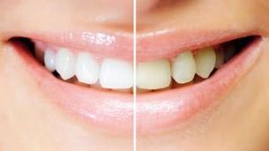 Image with missing alt attribute found on tag24.de