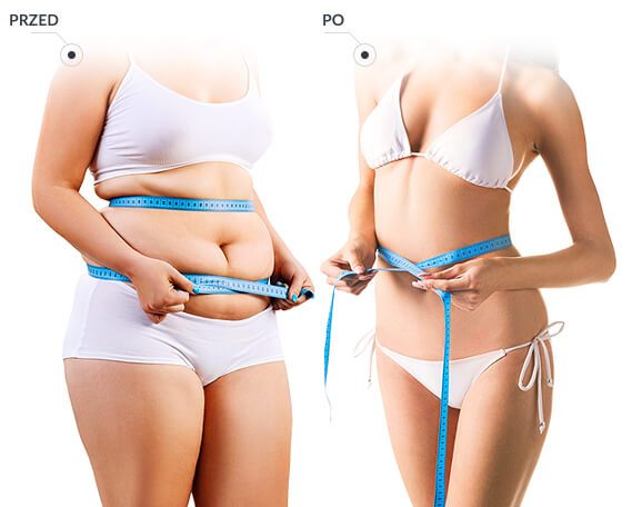 Image with missing alt attribute found on centrumliposukcji.pl