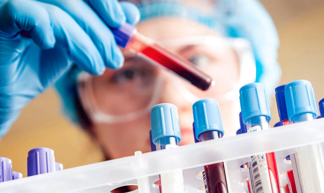 Badania krwi - Morfologia