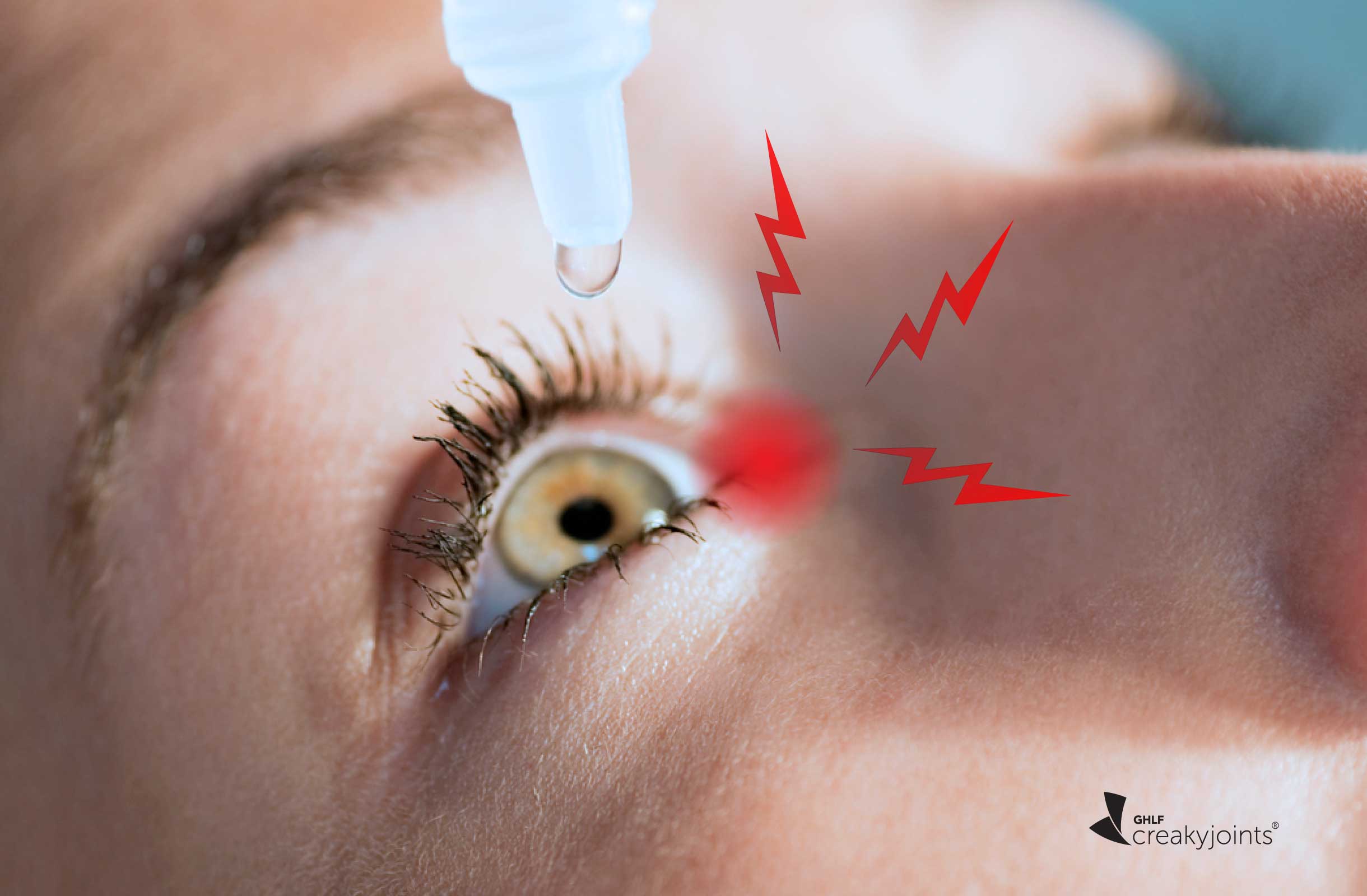 Image with missing alt attribute found on creakyjoints.org