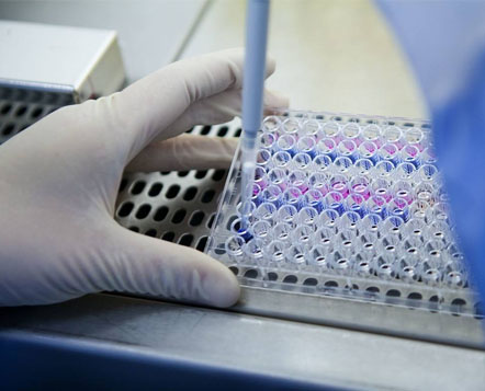 Image with missing alt attribute found on creative-diagnostics.com