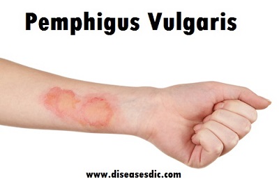 Image with missing alt attribute found on diseasesdic.com