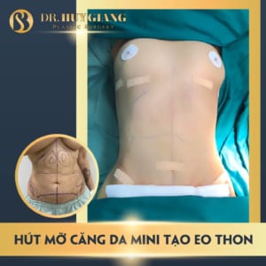 Image with missing alt attribute found on drhuygiang.vn