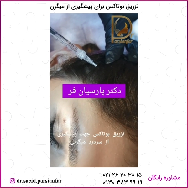 تزریق بوتاکس برای پیشگیری از میگرن