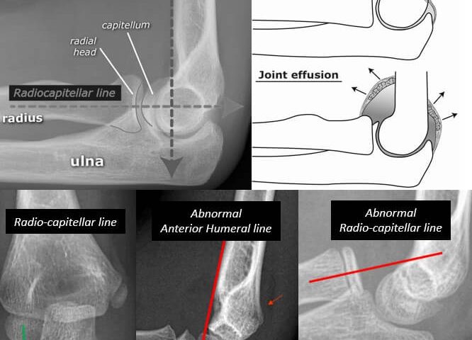 Image with missing alt attribute found on epomedicine.com