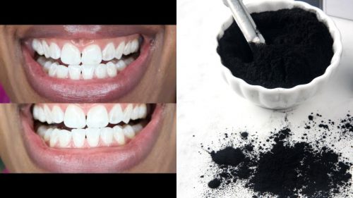 Whiten Your Teeth With Charcoal In These Simple Steps