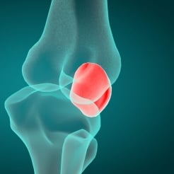 The Patella: Support for the Whole Body