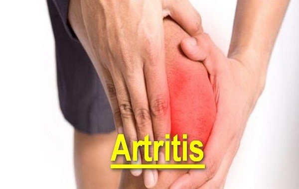 Image with missing alt attribute found on farmacianerea.com