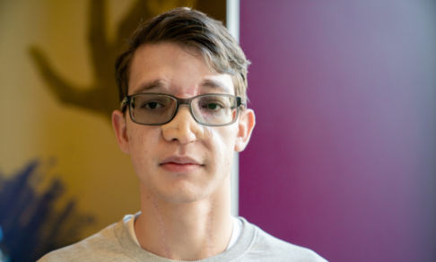 Олегу вырастили новый нос, но, чтобы он дышал, нужна еще одна операция