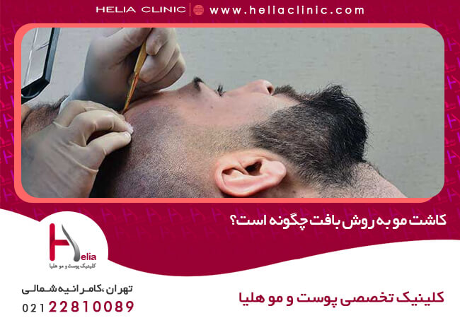 ترمیم مو به روش بافت