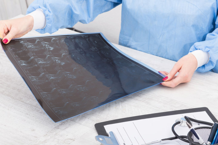 Image with missing alt attribute found on dxy.cn