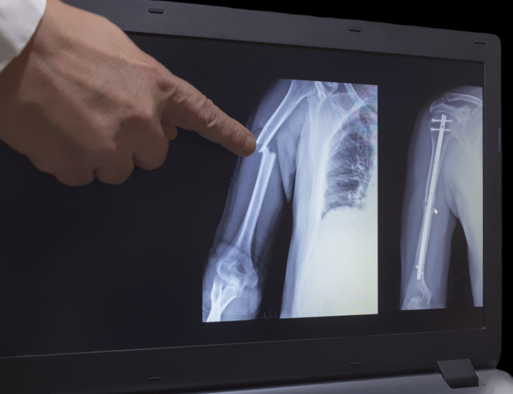 Image with missing alt attribute found on dxy.cn