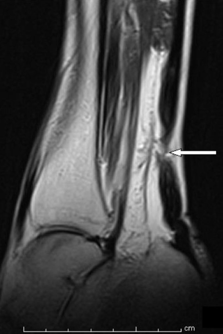 Image with missing alt attribute found on lermagazine.com