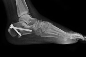 Image with missing alt attribute found on lermagazine.com