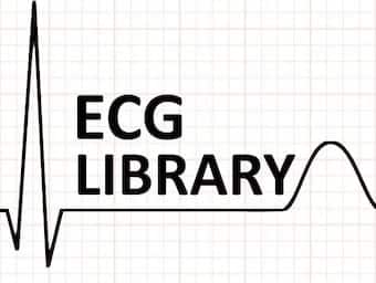 ECG Library LITFL