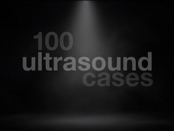 Top 100 ultrasound 340
