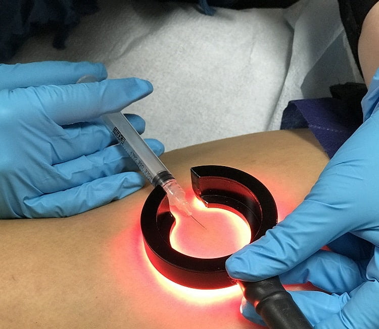 Ñêëåðîòåðàï³ÿ â Ñàìáîð³