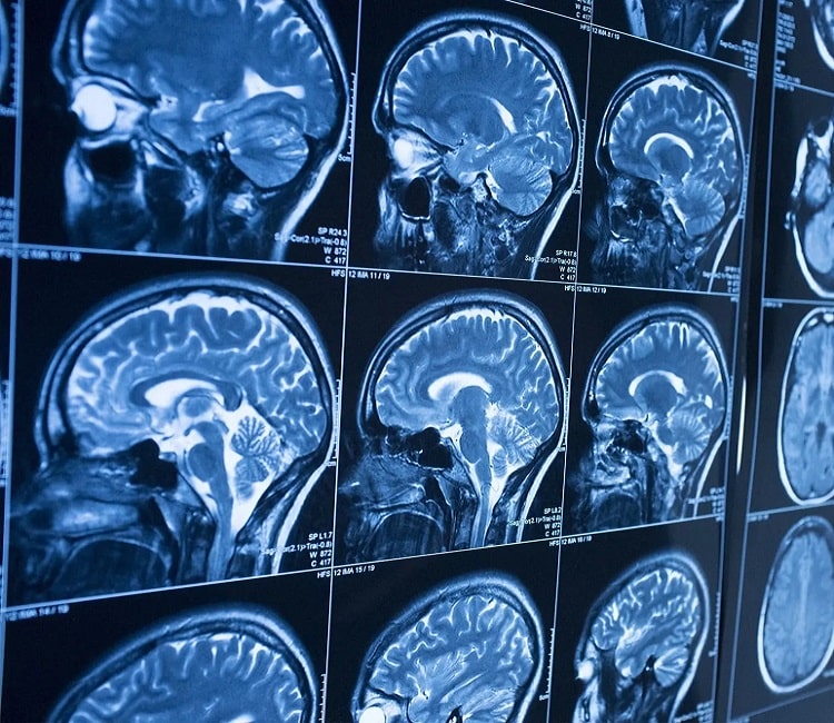 Êîíñóëüòàö³ÿ íåéðîõ³ðóðãà â Ñàìáîð³