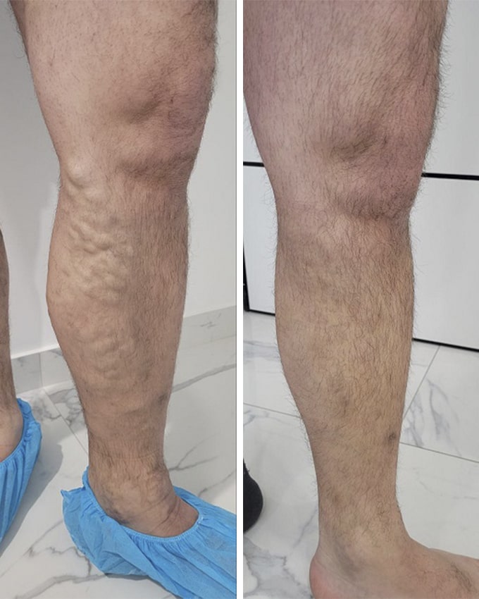 Ìåä³â³ò - ðåçóëüòàòè ðîáîòè