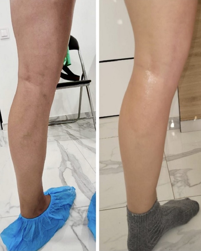 Medivit - ðåçóëüòàòè ðîáîòè