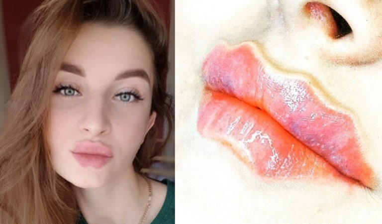 Губы дьявола: пугающий бьюти-тренд из инстаграма