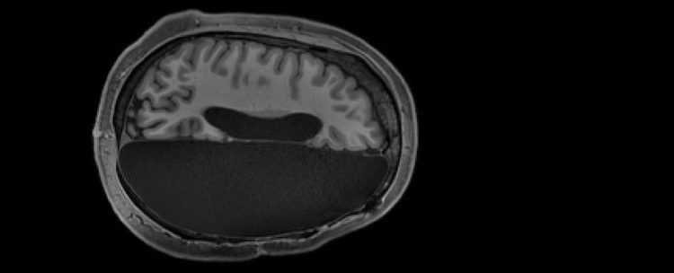 Image with missing alt attribute found on naked-science.ru