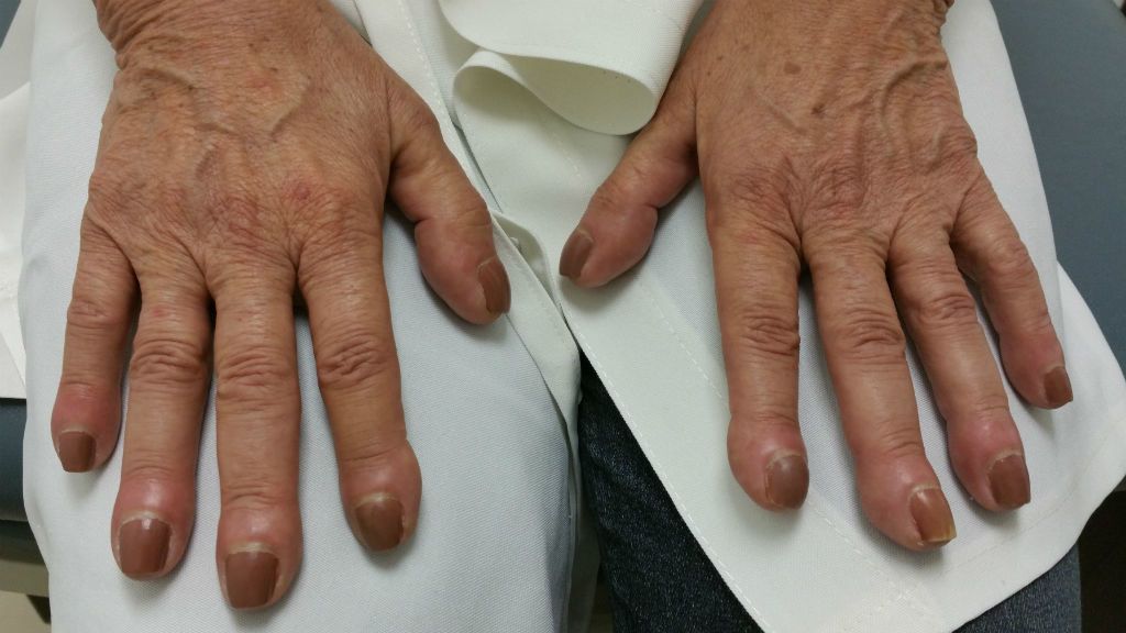 Image with missing alt attribute found on nlc.hu