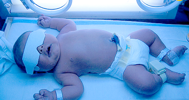 Image with missing alt attribute found on novintebiran.ir