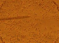 Covid-19 Aşıları Kısırlığa mı Yol Açıyor?