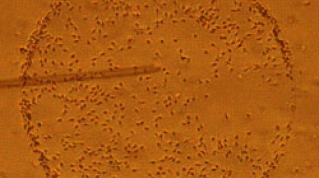 Covid-19 Aşıları Kısırlığa mı Yol Açıyor?