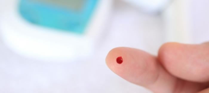 Image with missing alt attribute found on onsitehd.com