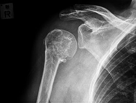 Arthrogram MRI Dallas Texas