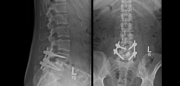 Image with missing alt attribute found on ryortho.com