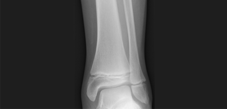 Image with missing alt attribute found on ryortho.com