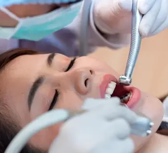 Find the Best Solution for Teeth Scaling Near You