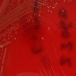 Image with missing alt attribute found on diariomedico.com