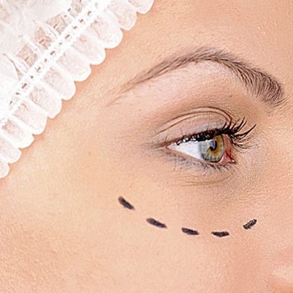 Image with missing alt attribute found on diariomedico.com