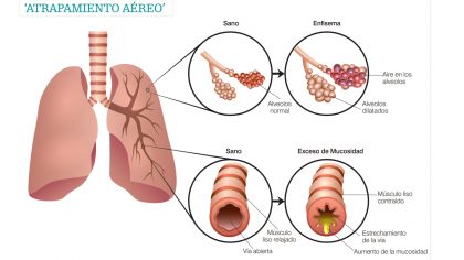 Image with missing alt attribute found on diariomedico.com