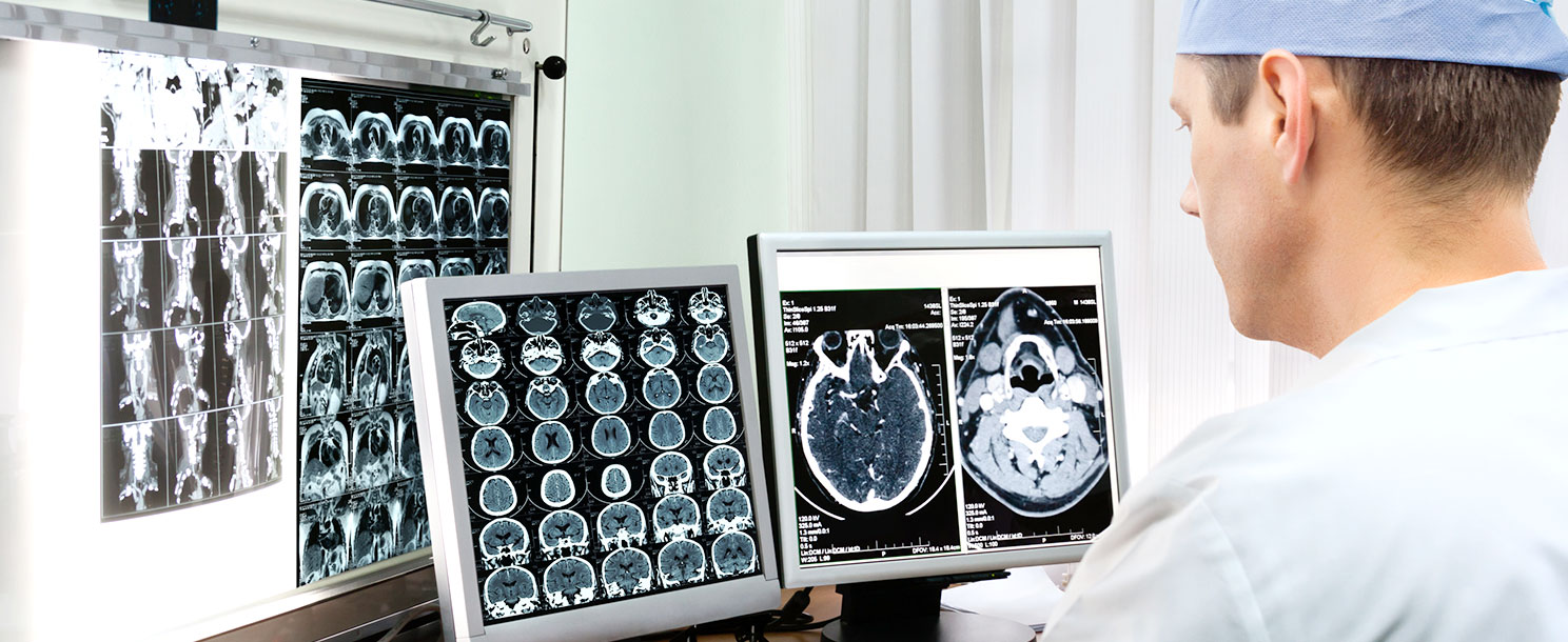 Image with missing alt attribute found on tebcan.com