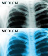 Image with missing alt attribute found on cpii.com