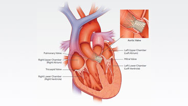 Image with missing alt attribute found on crozerkeystone.org